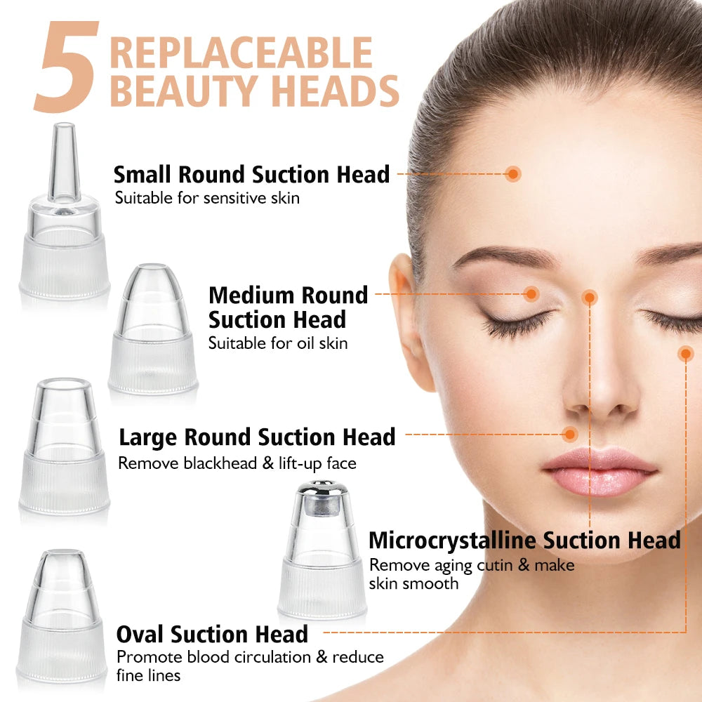 “Blackhead Vacuum Remover – Facial Pore Cleaner”